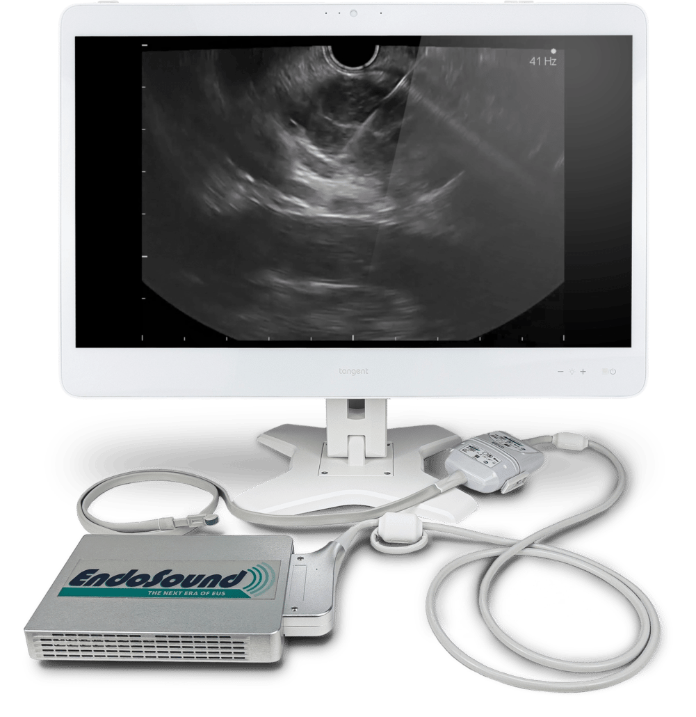 EndoSound Vision System